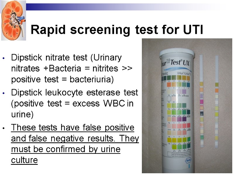 Rapid screening test for UTI Dipstick nitrate test (Urinary nitrates +Bacteria = nitrites >>